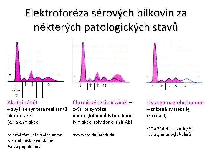 Elektroforéza sérových bílkovin za některých patologických stavů Akutní zánět Chronický aktivní zánět – aktivní