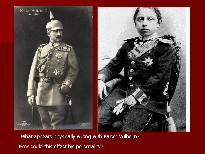 What appears physically wrong with Kaiser Wilhelm? How could this effect his personality? 