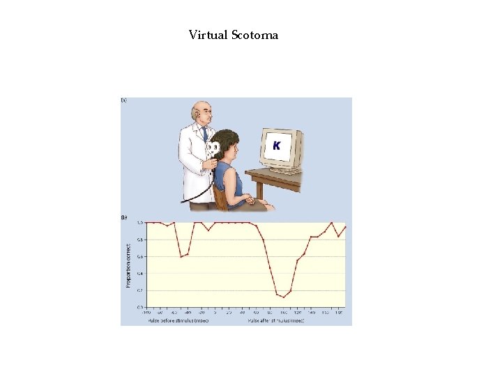 Virtual Scotoma Virtual Scotoma