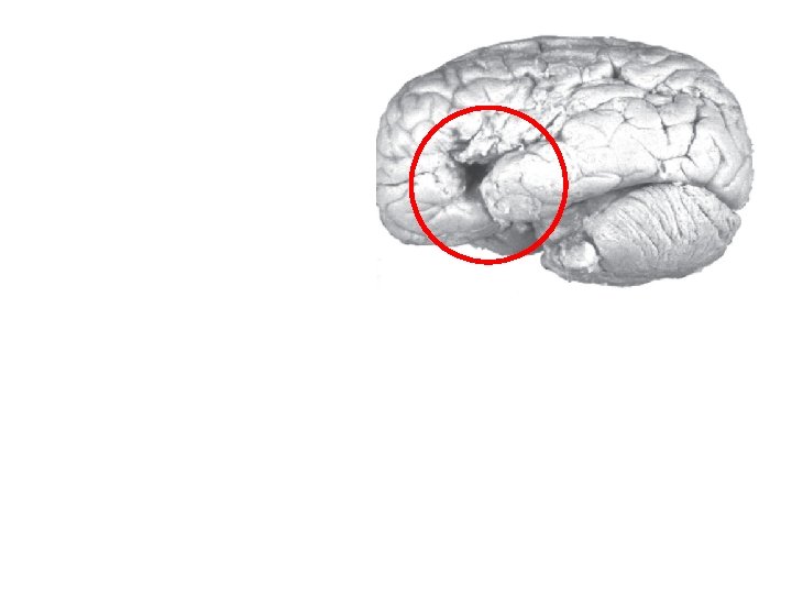 Broca’s Area: Broca’s aphasia: • language processing • results from damage to Broca’s Area Broca’s Area: Broca’s aphasia: • language processing • results from damage to Broca’s Area