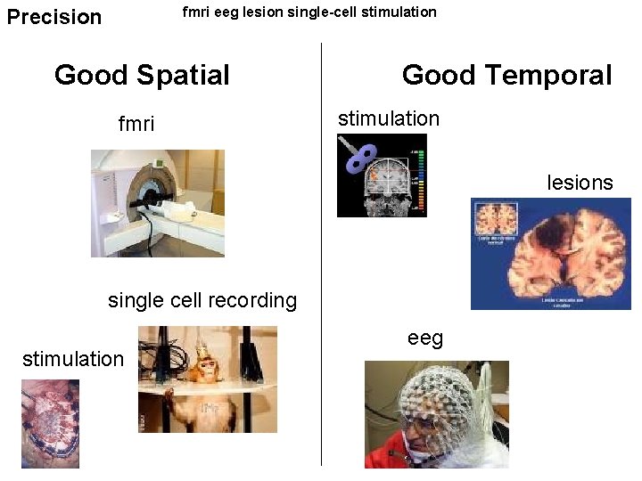 fmri eeg lesion single-cell stimulation Precision Good Spatial fmri Good Temporal stimulation lesions single fmri eeg lesion single-cell stimulation Precision Good Spatial fmri Good Temporal stimulation lesions single