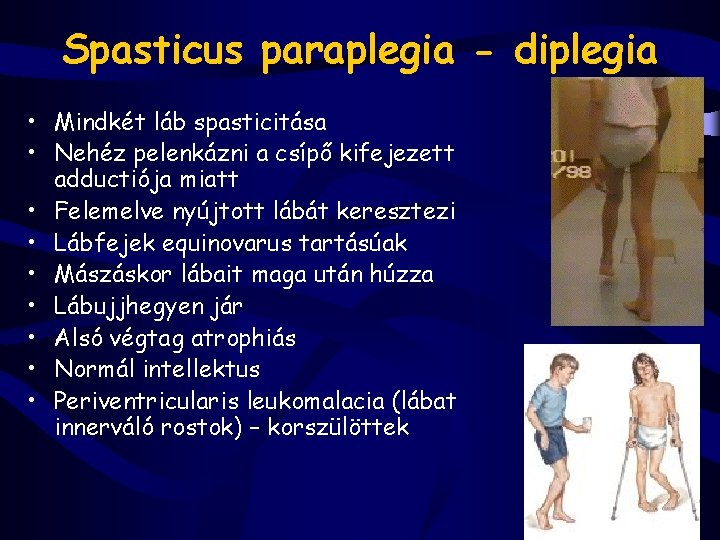 Spasticus paraplegia - diplegia • Mindkét láb spasticitása • Nehéz pelenkázni a csípő kifejezett