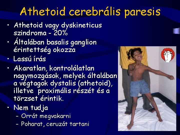 Athetoid cerebrális paresis • Athetoid vagy dyskineticus szindroma - 20% • Általában basalis ganglion