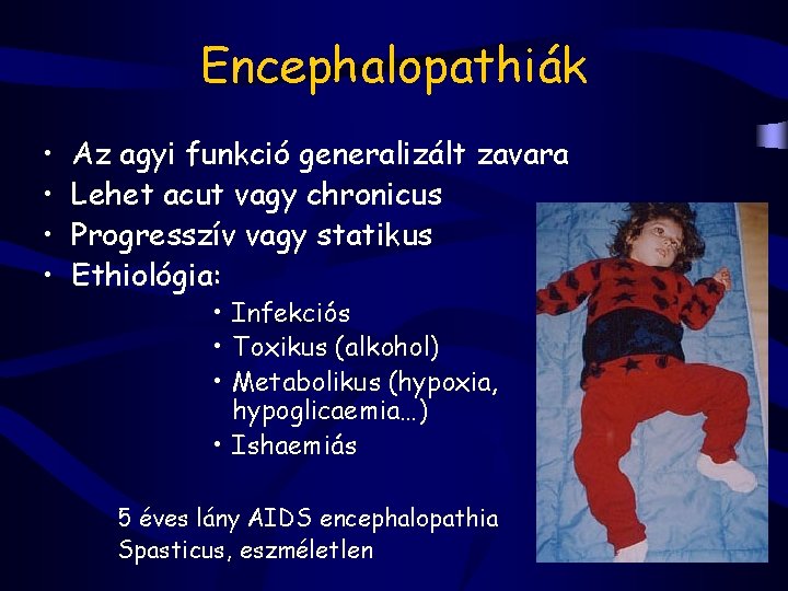 Encephalopathiák • • Az agyi funkció generalizált zavara Lehet acut vagy chronicus Progresszív vagy