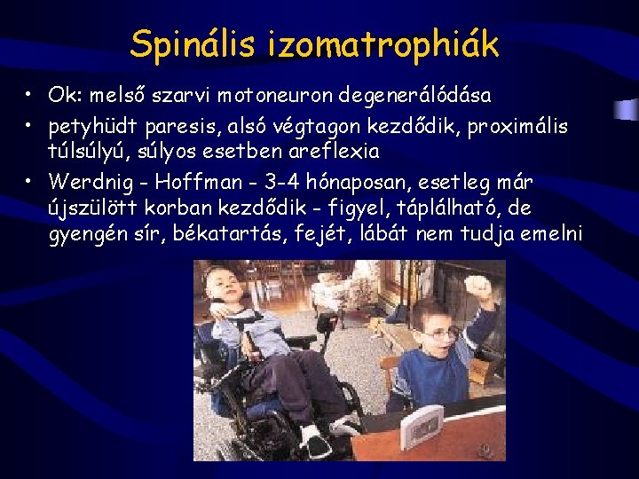 Spinális izomatrophiák • Ok: melső szarvi motoneuron degenerálódása • petyhüdt paresis, alsó végtagon kezdődik,