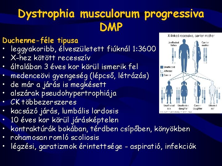 Dystrophia musculorum progressiva DMP Duchenne-féle tipusa • leggyakoribb, élveszületett fiúknál 1: 3600 • X-hez