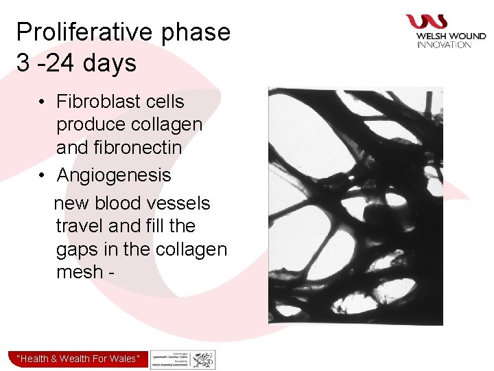 Proliferative phase 3 -24 days • Fibroblast cells produce collagen and fibronectin • Angiogenesis