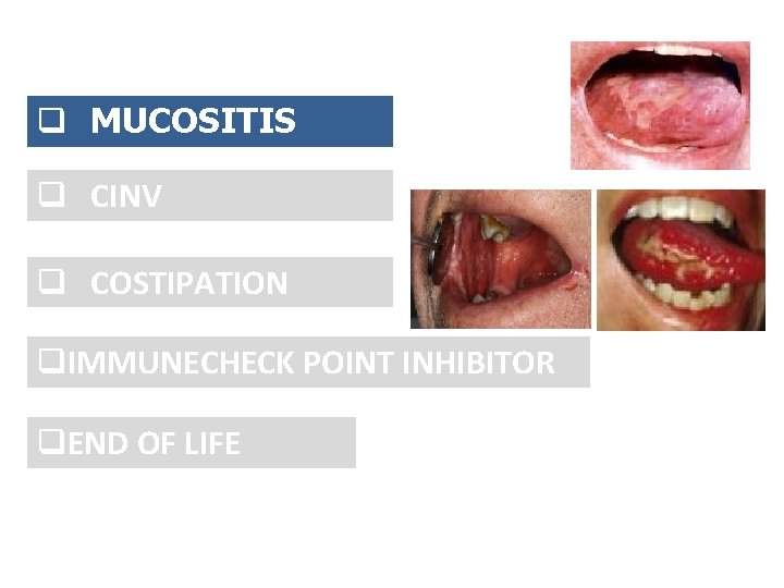 q MUCOSITIS q CINV q COSTIPATION q. IMMUNECHECK POINT INHIBITOR q. END OF LIFE