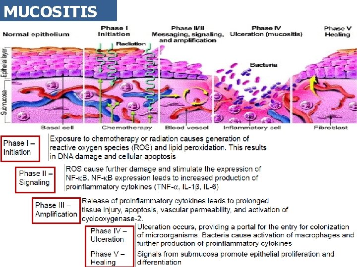 MUCOSITIS 