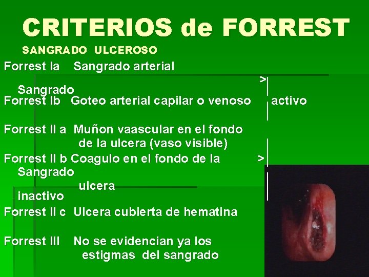 CRITERIOS de FORREST SANGRADO ULCEROSO Forrest la Sangrado arterial > Sangrado Forrest lb Goteo