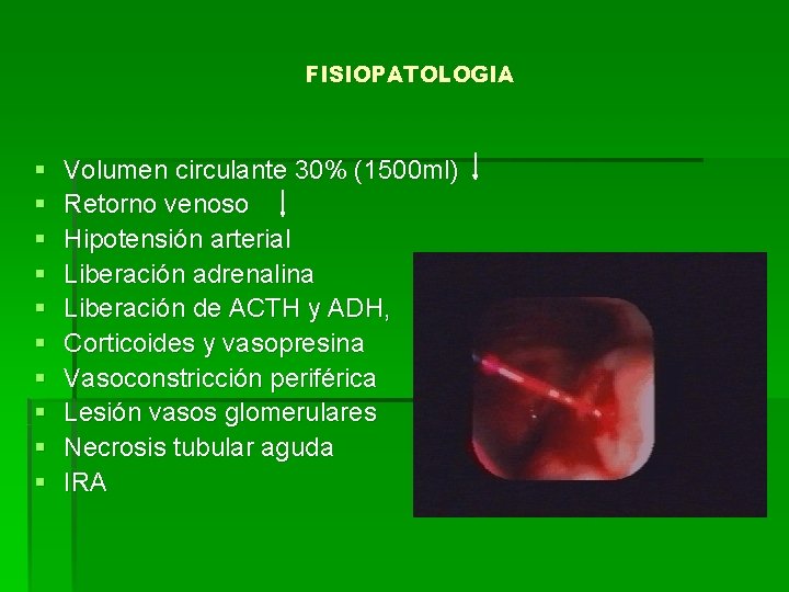 FISIOPATOLOGIA § § § § § Volumen circulante 30% (1500 ml) Retorno venoso Hipotensión