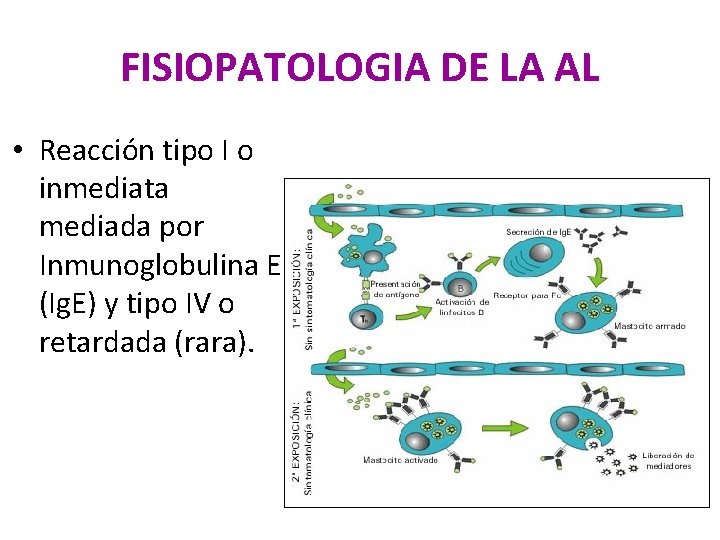 FISIOPATOLOGIA DE LA AL • Reacción tipo I o inmediata mediada por Inmunoglobulina E