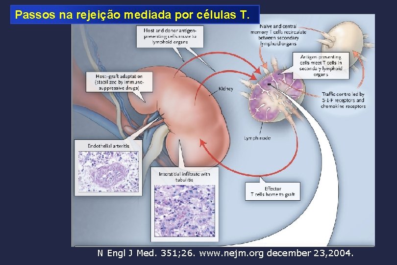 Passos na rejeição mediada por células T. N Engl J Med. 351; 26. www.