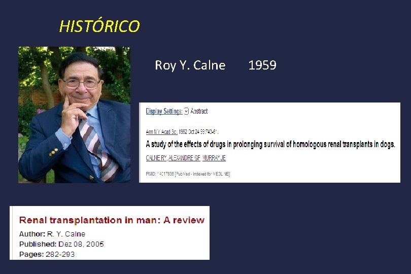 HISTÓRICO Roy Y. Calne 1959 