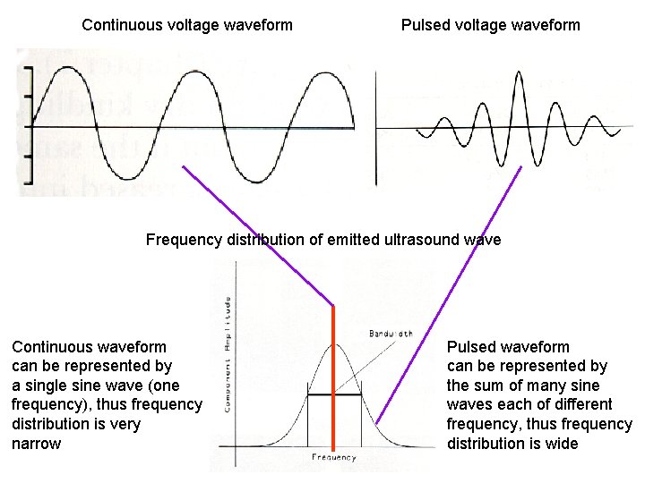 Continuous voltage waveform Pulsed voltage waveform Frequency distribution of emitted ultrasound wave Continuous waveform