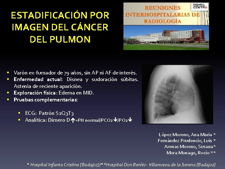 ESTADIFICACIÓN POR IMAGEN DEL CÁNCER DEL PULMON § Varón ex-fumador de 79 años, sin