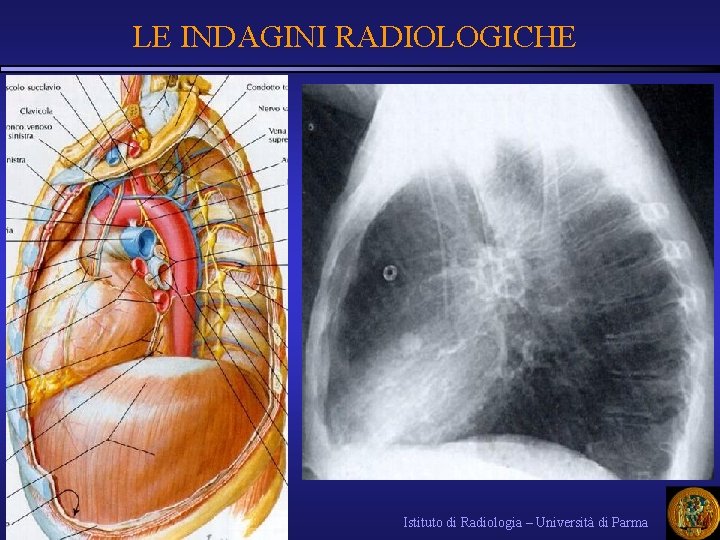 LE INDAGINI RADIOLOGICHE Istituto di Radiologia – Università di Parma 