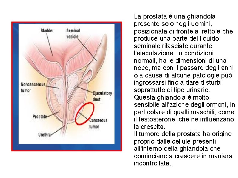 La prostata è una ghiandola presente solo negli uomini, posizionata di fronte al retto