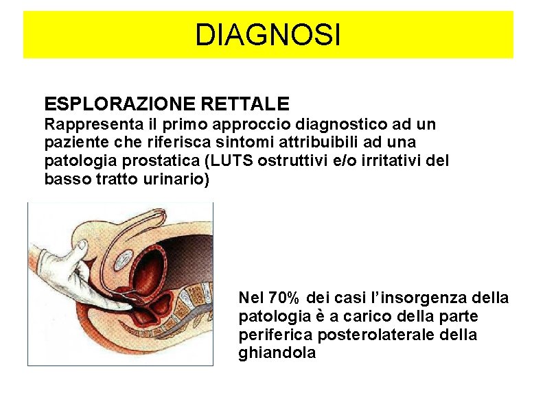 DIAGNOSI ESPLORAZIONE RETTALE Rappresenta il primo approccio diagnostico ad un paziente che riferisca sintomi