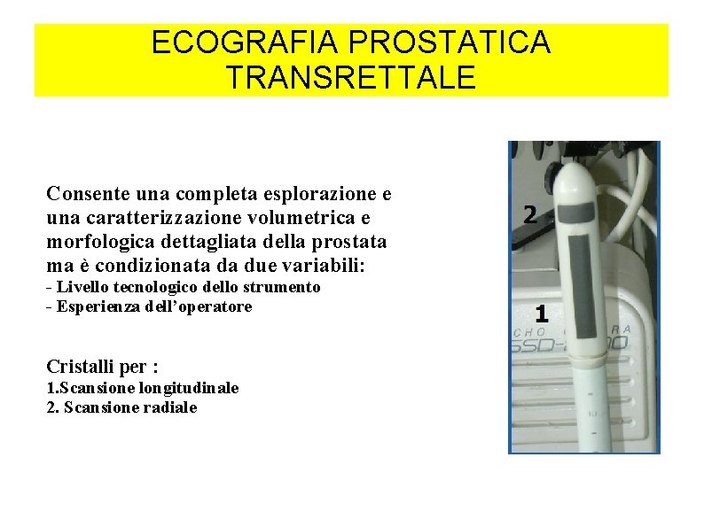 ECOGRAFIA PROSTATICA TRANSRETTALE Consente una completa esplorazione e una caratterizzazione volumetrica e morfologica dettagliata