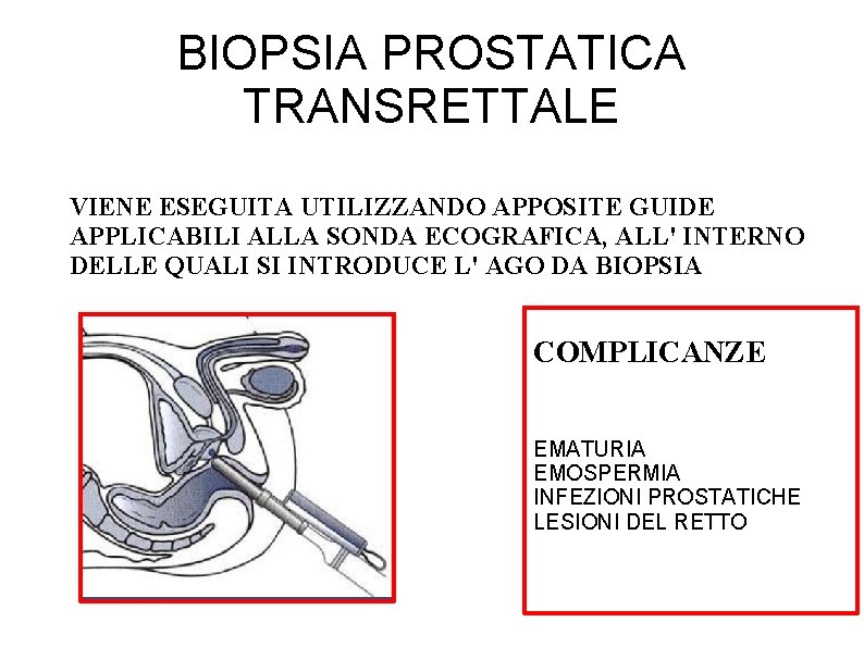 BIOPSIA PROSTATICA TRANSRETTALE VIENE ESEGUITA UTILIZZANDO APPOSITE GUIDE APPLICABILI ALLA SONDA ECOGRAFICA, ALL' INTERNO