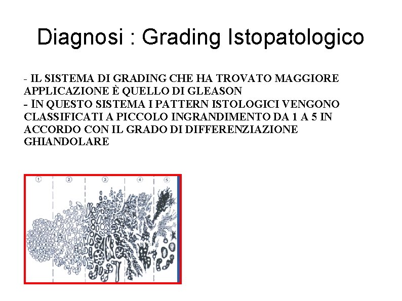 Diagnosi : Grading Istopatologico - IL SISTEMA DI GRADING CHE HA TROVATO MAGGIORE APPLICAZIONE