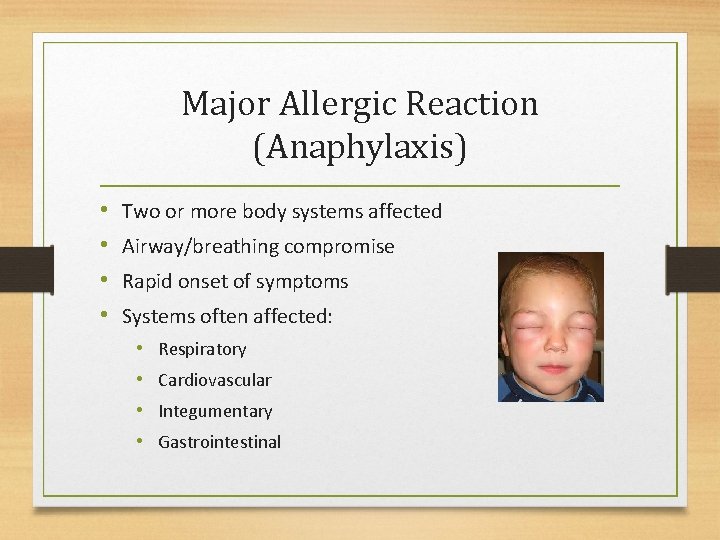 Major Allergic Reaction (Anaphylaxis) • • Two or more body systems affected Airway/breathing compromise