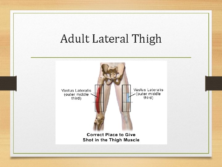 Adult Lateral Thigh 