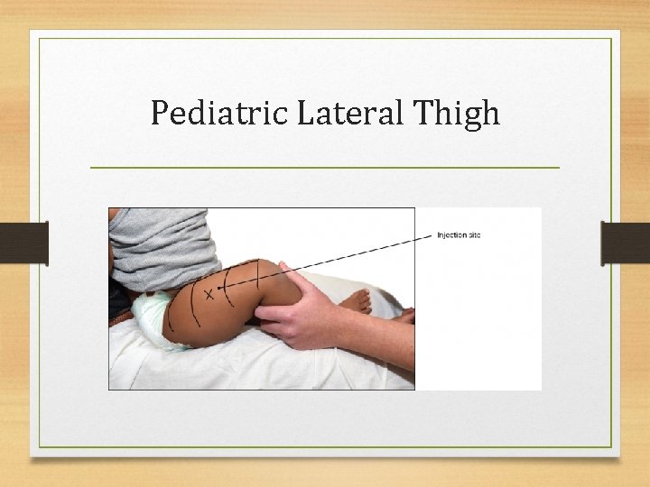 Pediatric Lateral Thigh 