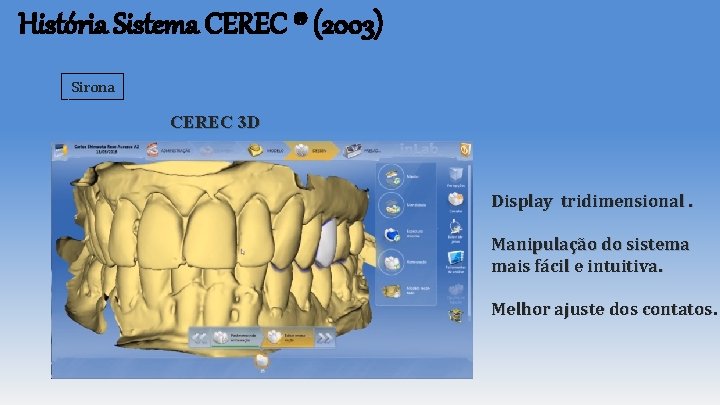 História Sistema CEREC ® (2003) Sirona CEREC 3 D Display tridimensional. Manipulação do sistema História Sistema CEREC ® (2003) Sirona CEREC 3 D Display tridimensional. Manipulação do sistema