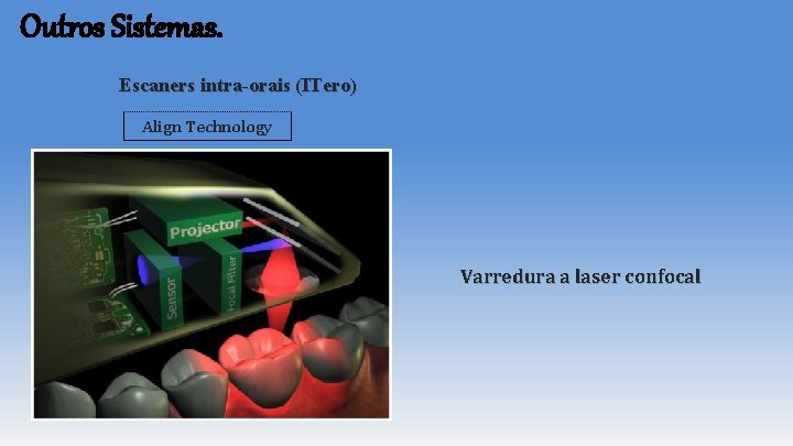 Outros Sistemas. Escaners intra-orais (ITero) Align Technology Varredura a laser confocal Outros Sistemas. Escaners intra-orais (ITero) Align Technology Varredura a laser confocal