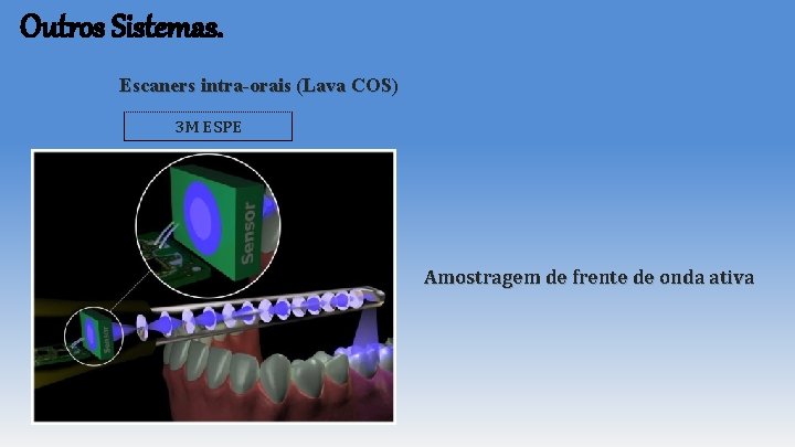 Outros Sistemas. Escaners intra-orais (Lava COS) 3 M ESPE Amostragem de frente de onda Outros Sistemas. Escaners intra-orais (Lava COS) 3 M ESPE Amostragem de frente de onda