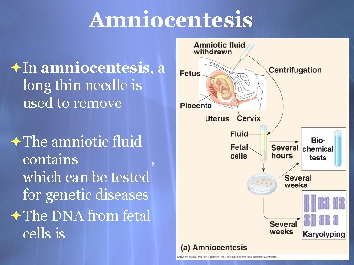 Amniocentesis In amniocentesis, a long thin needle is used to remove The amniotic fluid Amniocentesis In amniocentesis, a long thin needle is used to remove The amniotic fluid