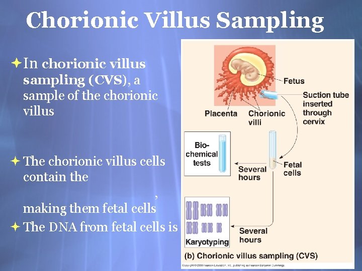 Chorionic Villus Sampling In chorionic villus sampling (CVS), a sample of the chorionic villus