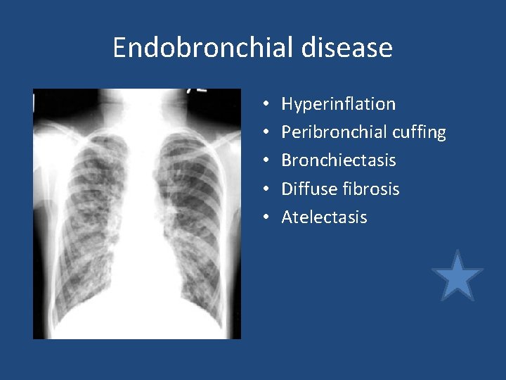 Endobronchial disease • • • Hyperinflation Peribronchial cuffing Bronchiectasis Diffuse fibrosis Atelectasis Endobronchial disease • • • Hyperinflation Peribronchial cuffing Bronchiectasis Diffuse fibrosis Atelectasis
