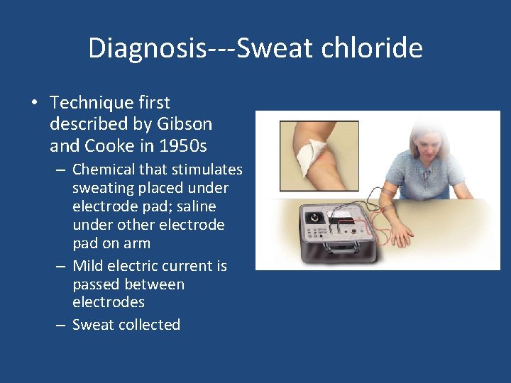 Diagnosis---Sweat chloride • Technique first described by Gibson and Cooke in 1950 s – Diagnosis---Sweat chloride • Technique first described by Gibson and Cooke in 1950 s –