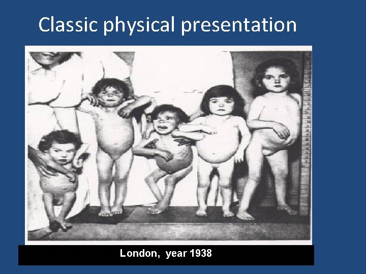 Classic physical presentation London, year 1938 Classic physical presentation London, year 1938
