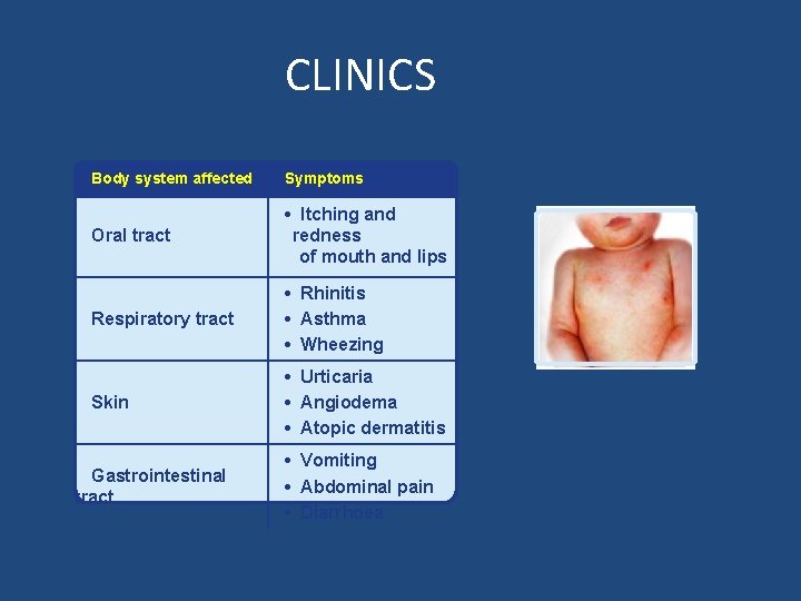CLINICS Body system affected Symptoms Oral tract • Itching and redness of mouth and CLINICS Body system affected Symptoms Oral tract • Itching and redness of mouth and