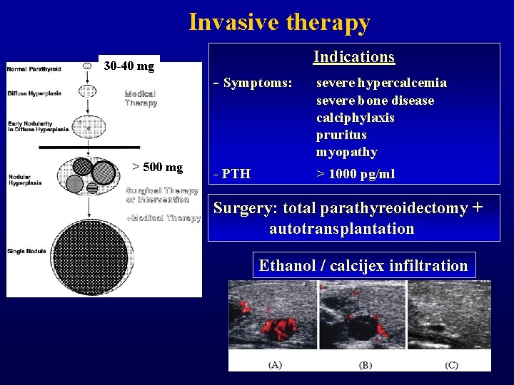 Invasive therapy 30 -40 mg > 500 mg Indications - Symptoms: severe hypercalcemia severe Invasive therapy 30 -40 mg > 500 mg Indications - Symptoms: severe hypercalcemia severe
