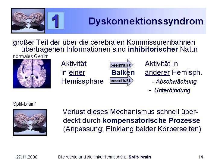Dyskonnektionssyndrom großer Teil der über die cerebralen Kommissurenbahnen übertragenen Informationen sind inhibitorischer Natur normales