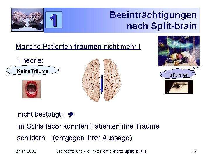 Beeinträchtigungen nach Split-brain Manche Patienten träumen nicht mehr ! Theorie: „Keine. Träume “ träumen