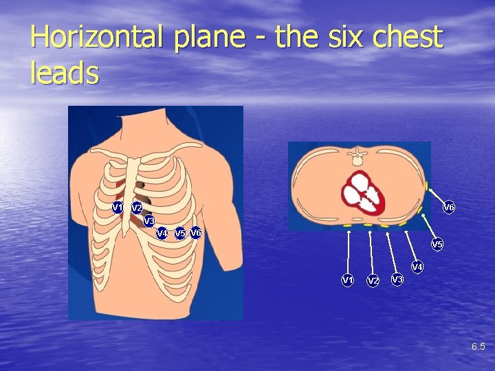 Horizontal plane - the six chest leads LA RA V 1 V 2 LV