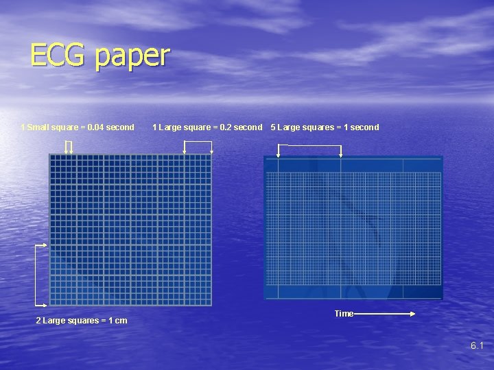 ECG paper 1 Small square = 0. 04 second 2 Large squares = 1