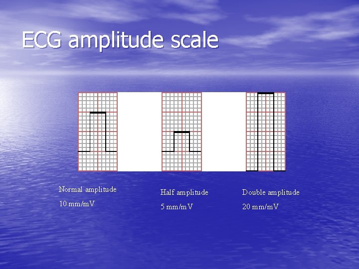 ECG amplitude scale Normal amplitude Half amplitude Double amplitude 10 mm/m. V 5 mm/m.