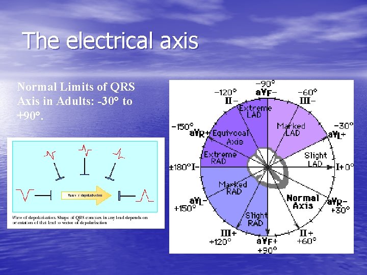 The electrical axis Normal Limits of QRS Axis in Adults: -30° to +90°. 