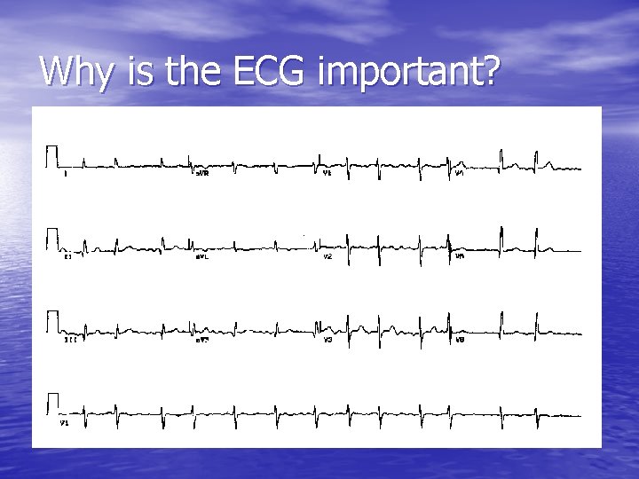 Why is the ECG important? 