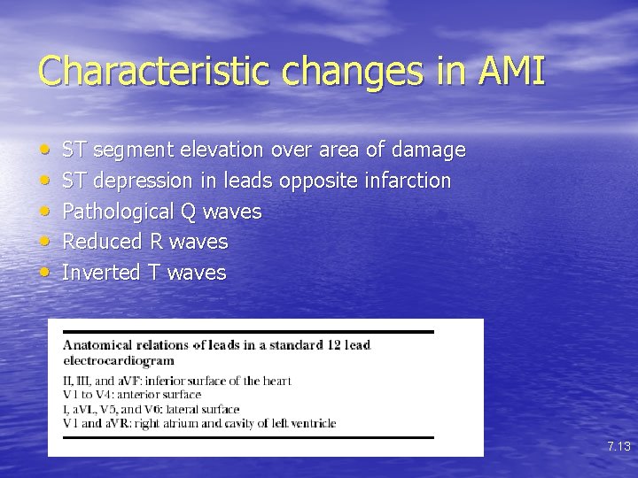 Characteristic changes in AMI • • • ST segment elevation over area of damage