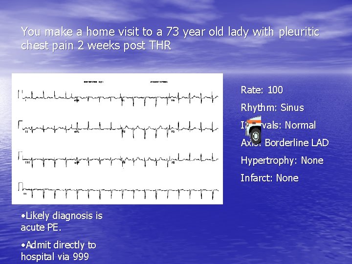 You make a home visit to a 73 year old lady with pleuritic chest