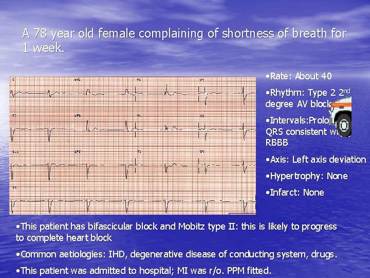 A 78 year old female complaining of shortness of breath for 1 week. •