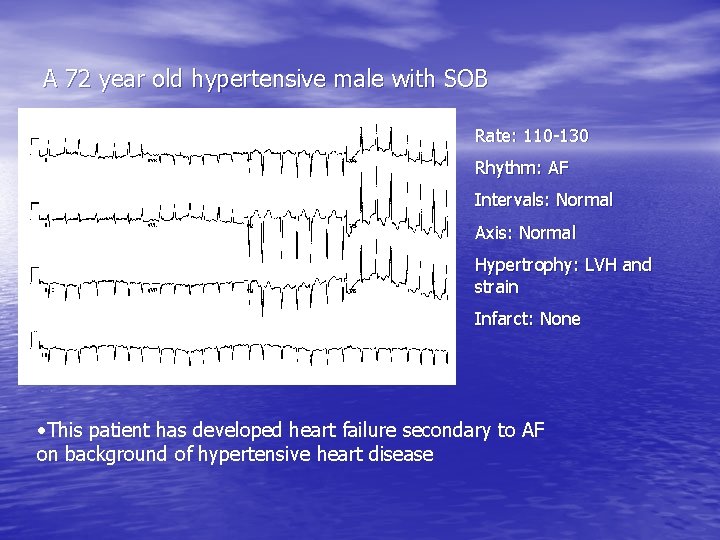 A 72 year old hypertensive male with SOB Rate: 110 -130 Rhythm: AF Intervals: